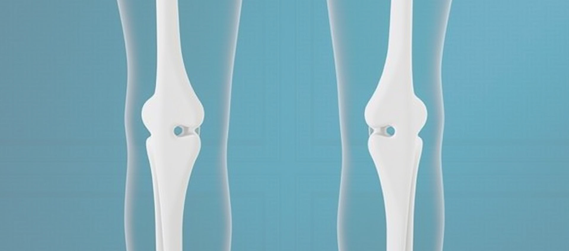 LiposomalビタミンD3