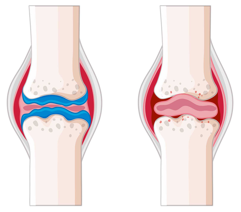 骨と心血管の健康を促進します